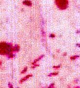 ピロリ菌の画像